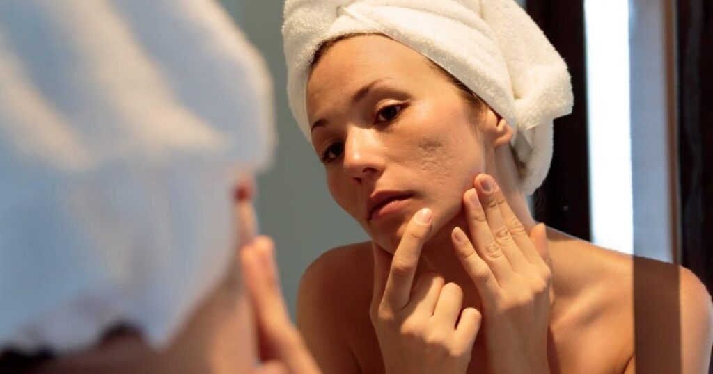 Effective Means of Scar Removals