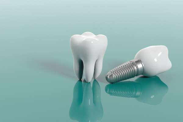 Replacing Teeth